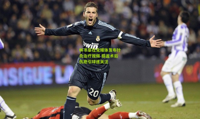 林书豪社交媒体发布针灸治疗视频 膝盖术后伤疤引球迷关注